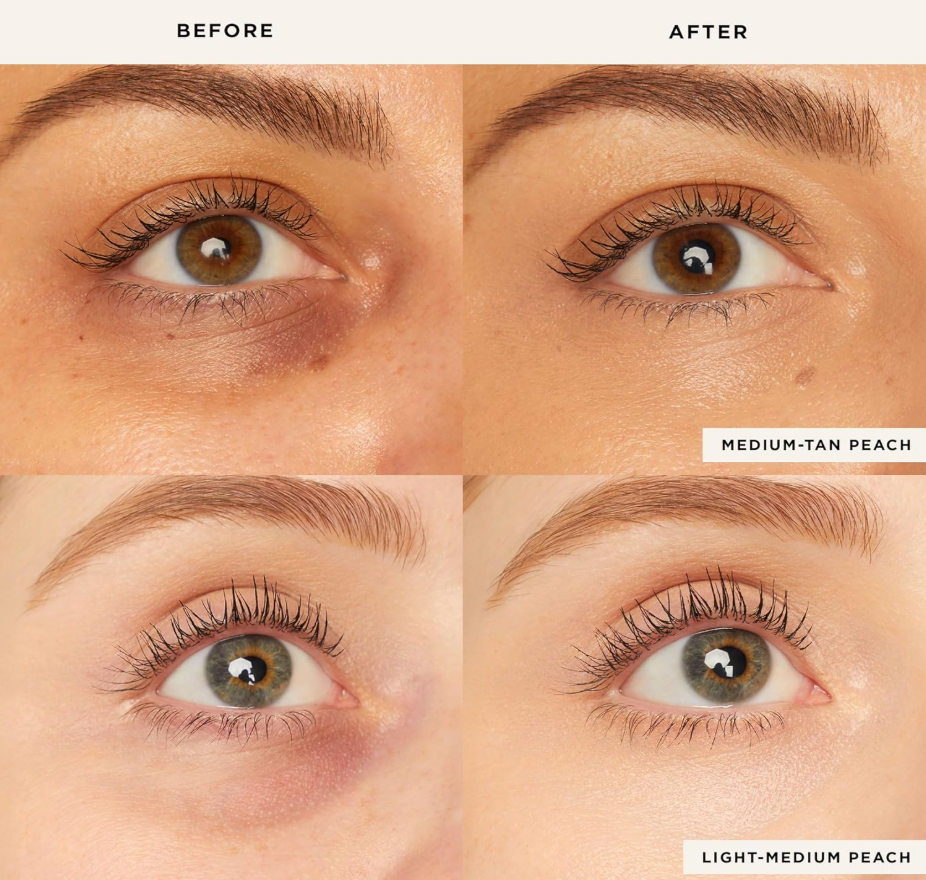 GlowMuse Radiant Eye Corrector